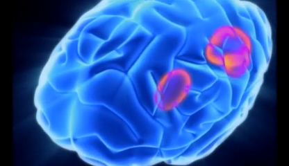 Parts of the Brain Affected by Dyslexia